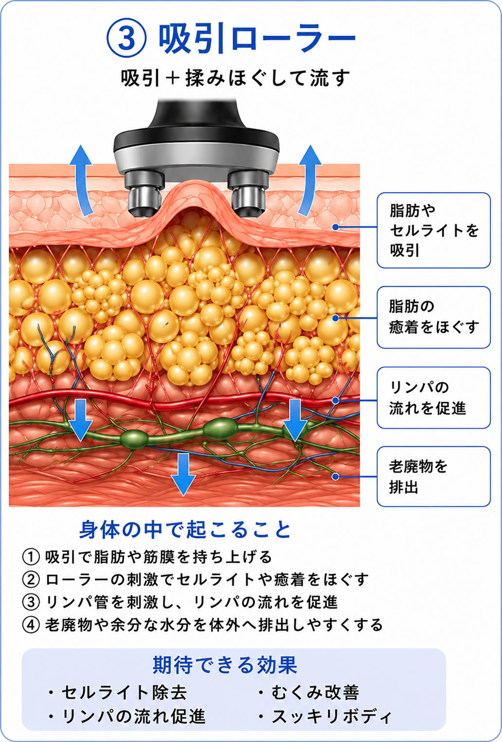 吸引ローラー図解画像